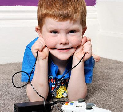 В Британии 5-летний мальчик каждый день питается проводами